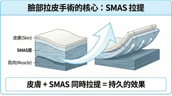 面部拉提手術完美指南：整形外科專科醫師告訴您的一切