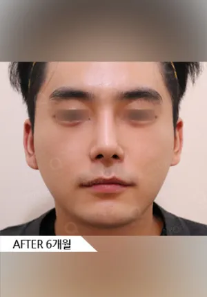 After