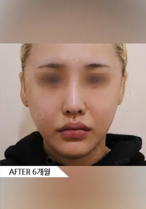 After