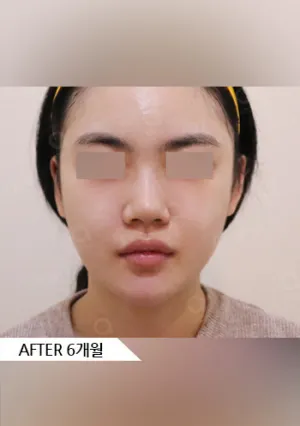 After