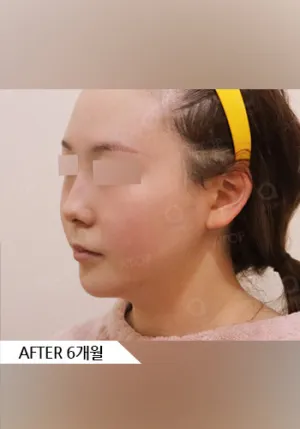After