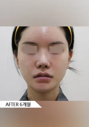 After