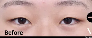 Before