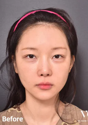 Before