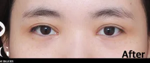 After