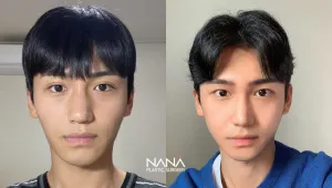 After