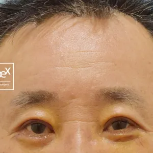 After