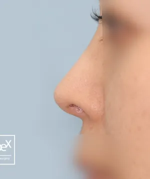 After