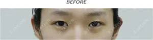 Before