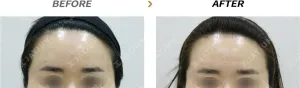Before