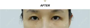 After