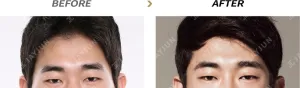 Before