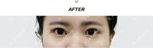 After