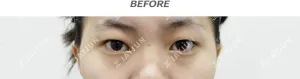 Before