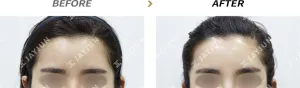 Before