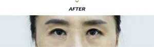 After