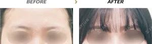 Before