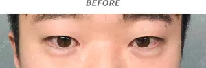 Before