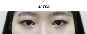 After