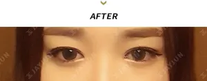 After