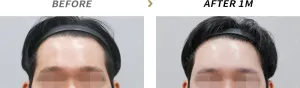 Before