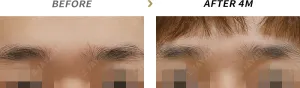 Before