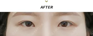 After