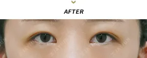 After