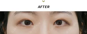 After