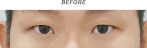 Before