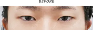 Before