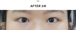 After