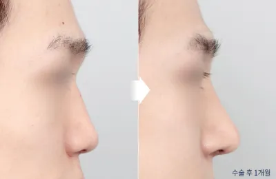 Before & After