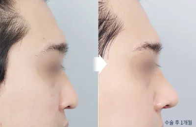 Before & After