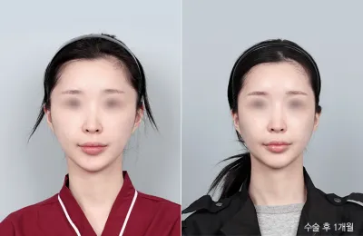 Before & After