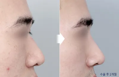 Before & After