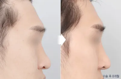 Before & After