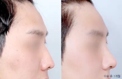 Before & After