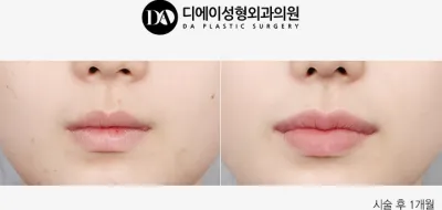 Before & After