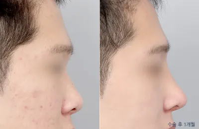Before & After