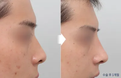 Before & After