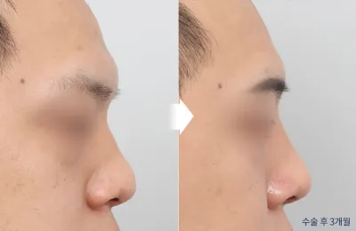 Before & After