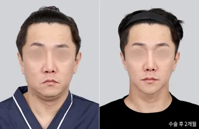 Before & After