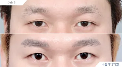 Before & After