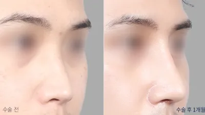 Before & After