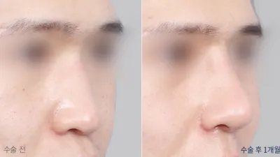 Before & After