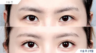 Before & After