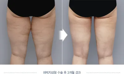 Before & After