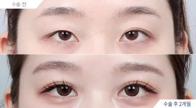 Before & After