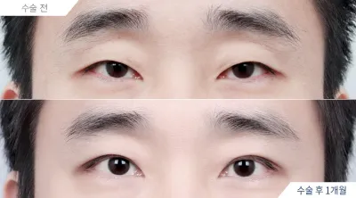 Before & After